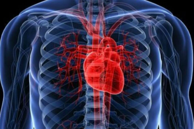 Impacto cardiovascular del Covid-19 en Argentina